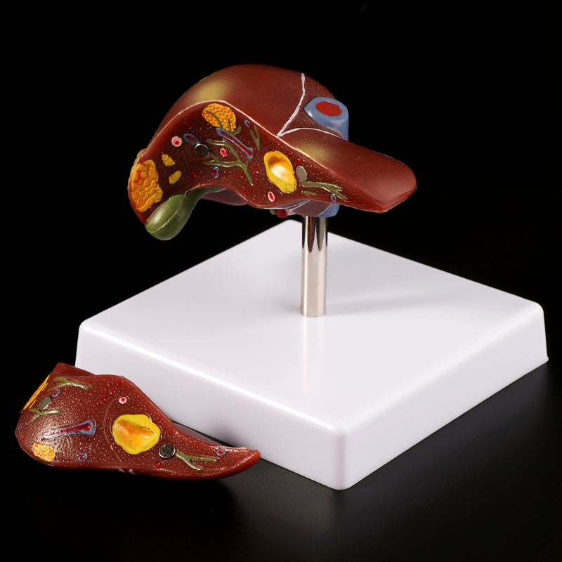 Medical Lab Design - Modelo anatômico de fígado humano, equipamento