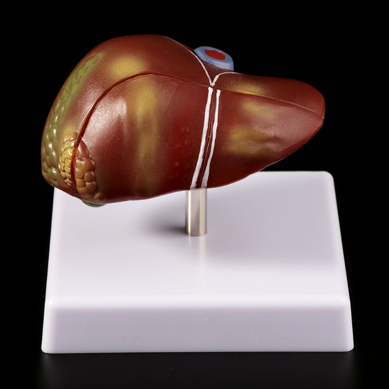 Modelo anatômico de fígado hum - Medical Lab Design avaliação e preço