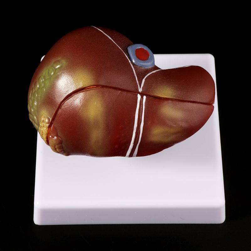 Modelo anatômico de fígado hum - Medical Lab Design avaliação e preço